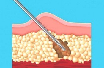 Lipitning samaradorligi