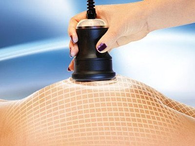 Ultrasonik liposuction - bu nima?