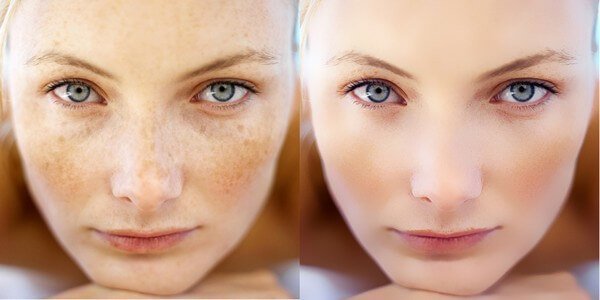 Chilimlarni olishdan oldin va keyin