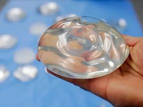 Mammoplastika joylashtiradigan