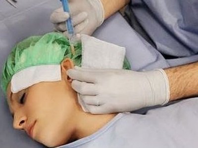 Otoplastik lazer yoki bosh terisi operatsiyalari