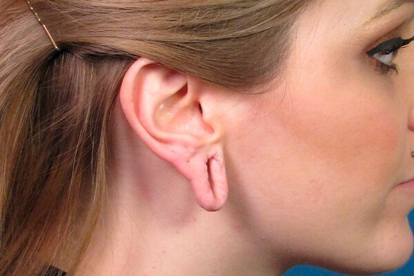 Tunneldan keyin quloqlar